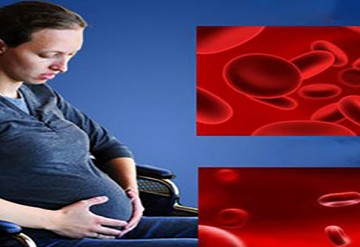 دارودرمانی کم‌ خونی فقر آهن در خانم های باردار