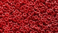 درمان کاهش تعداد سلول های قرمز خون پیش از جراحی توسط مکمل آهن 