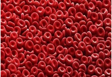درمان کاهش تعداد سلول های قرمز خون پیش از جراحی توسط مکمل آهن 