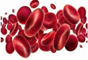 مدیریت بالینی کم خونی ناشی از کمبود آهن: پیشرفت های جدید در تشخیص و درمان آن