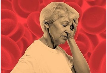 مدیریت کم خونی ناشی از کمبود آهن در افراد مسن