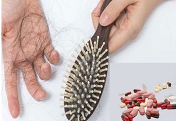 آشنایی با علل ریزش مو و درمان توسط مکمل ها