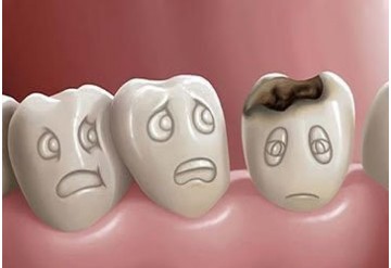کم خونی ناشی از کمبود آهن و سلامت دهان