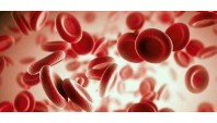 تاثیر کم خونی ناشی از کمبود آهن بر پروفایل انعقاد خون